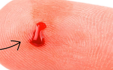 Có những dấu hiệu dưới đây chứng tỏ bạn đang thiếu máu trầm trọng, đừng chủ quan