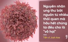 Tiến sĩ Mỹ vạch mặt 11 thủ phạm gây ung thư "không ai ngờ" trong cuộc sống hiện đại