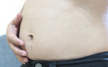 Vì coi thường tình trạng chướng bụng, nhiều người đang có nguy cơ mắc 5 bệnh nguy hiểm