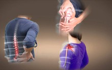 Thay đổi chế độ ăn chỉ có rau quả trong 3 tuần, người phụ nữ nhận kết quả bất ngờ khi các triệu chứng viêm khớp hầu như biến mất