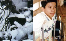 Người Việt đầu tiên bị dính liền cơ thể trở thành giáo sư thỉnh giảng tại Nhật Bản