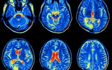 Làm thế nào để nhìn vào bên trong cơ thể? Chụp hình y khoa đã và sẽ mở ra những kỷ nguyên y học mới