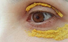 Phương thuốc kỳ diệu của Ấn Độ chữa nhiều bệnh bằng bột nghệ