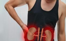 Thải độc và ngăn ngừa sỏi thận bằng thứ quả quen thuộc, gia đình Việt nào cũng có trong bếp