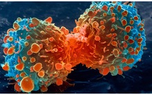 Nghiên cứu mới: Không phải do thực phẩm bẩn hay môi trường ô nhiễm, nguyên nhân hàng đầu gây ung thư là do lỗi sao chép DNA