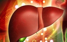 9 thực phẩm vừa loại bỏ chất độc vừa bảo vệ gan bạn nên ăn hàng ngày