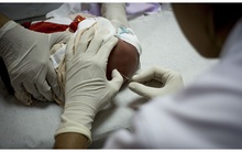 Sự suy tàn của kháng sinh Penicillin và mối đe dọa đến hàng triệu tính mạng trên toàn cầu