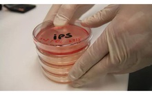 Điều trị bằng tế bào gốc: Hướng đi tất yếu của y học hiện đại