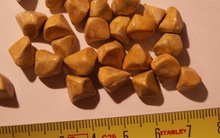 5 dấu hiệu cảnh báo bạn mắc sỏi mật