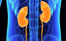 Đi tiểu kèm triệu chứng này ở đầu và tim, cẩn thận một khối u thầm tiến triển