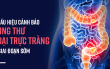 Nếu sáng ngủ dậy đau bụng hoặc có triệu chứng sau, bạn nên khẩn trương đi khám ung thư