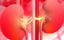 [Đọc nhanh] Danh y hướng dẫn cách làm sạch thận, đây là việc quan trọng ai cũng nên làm