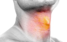 7 triệu chứng cảnh báo ung thư đầu cổ