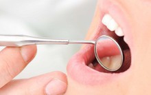 9 biện pháp khắc phục và ngăn ngừa tình trạng khô miệng bạn hoàn toàn có thể làm ở nhà