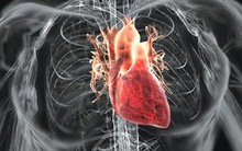 10 “thực phẩm vàng” tốt nhất cho sức khỏe tim mạch bạn nên ăn ngay từ giờ