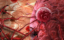 Ai cũng có tế bào ung thư trong cơ thể: 3 nguyên tắc vàng chặn đứng sự hình thành khối u