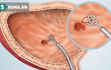 Bác sĩ Bệnh viện Đại học Y hướng dẫn bài tập khi đi tiểu giúp phòng ung thư bàng quang