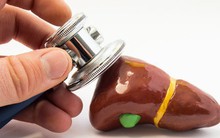 Những người dễ bị mệt mỏi là do gan không khỏe: Đây là những điều bạn nên làm để "cứu" gan