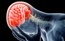 8 cách hữu hiệu để ngăn ngừa căn bệnh nguy hiểm có thể gây tử vong gần như ngay lập tức