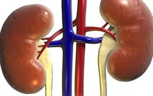 BS nêu nguyên nhân gây yếu thận và cách khắc phục bạn nên áp dụng sớm để không "mất" thận