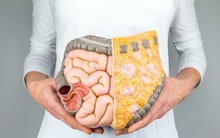 Đây mới là loại chất béo trong cơ thể cần loại bỏ đầu tiên vì nó vừa "cứng đầu" vừa khiến đe dọa sức khỏe của bạn