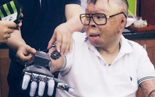 Cái Tết ý nghĩa nhất của chiến sĩ sống sót vụ trực thăng rơi sau khi được lắp tay giả