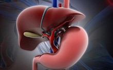 3 nguyên tắc ngừa gan nhiễm mỡ từ xa: Đừng để mắc bệnh rồi mới phòng bệnh