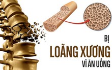 5 cách ăn uống "hủy hoại" xương nhanh chóng: Nếu kéo dài thì hậu quả sẽ rất nghiêm trọng