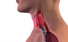 Cách phân biệt giữa viêm họng và ung thư thực quản: Nhầm lẫn sẽ đánh mất cơ hội chữa bệnh