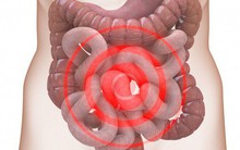 11 dấu hiệu nhắc bạn cần "dọn sạch" độc tố ra khỏi cơ thể ngay lập tức