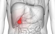 Đừng chủ quan khi gặp phải những triệu chứng này, rất có thể chúng là nguyên nhân gây bệnh sỏi mật