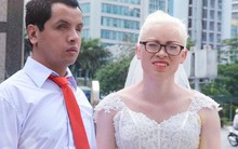 Chuyện tình cảm động phía sau đám cưới của chú rể khiếm thị và cô dâu đột biến gen có mái tóc bạc trắng ở Hà Nội