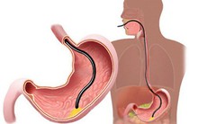 Cách tự làm "thông" 5 cái lỗ trên cơ thể: Ai áp dụng được sẽ khỏi lo bị bệnh tật tấn công