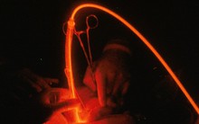 Kì diệu liệu pháp chữa bệnh ung thư bằng ánh sáng của các nhà khoa học Nhật Bản