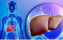 Làm sạch gan bằng những thực phẩm sẵn có hàng ngày