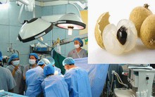 Từ vụ bé trai hóc nhãn phải sống thực vật: Bác sĩ chỉ cách sơ cứu cha mẹ nào cũng cần biết