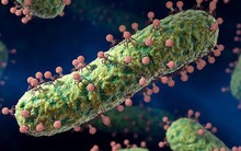 Virus có thể lây nhiễm và giết chết siêu vi khuẩn, tại sao không dùng chúng thay cho thuốc kháng sinh đã mất tác dụng?