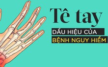 Bị tê tay vào ban đêm là dấu hiệu cảnh báo hội chứng ống cổ tay rất nguy hiểm