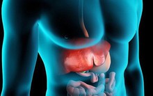 BS nêu đích danh 7 "sát thủ" gây hại cho gan: Nhiều người đang "nuôi" chúng mà không biết