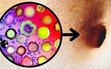 BS khuyên: 4 bộ phận trên cơ thể không nên vệ sinh quá sạch sẽ, nhiều người đang làm ngược