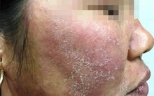 Sử dụng kem trộn trôi nổi trên mạng xã hội: Rước họa vào thân