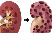 Thận là bộ phận nội tạng quan trọng: Hơi thở có mùi bất thường này là thận đang có bệnh