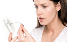 7 dấu hiệu bất thường cảnh báo sức khỏe đang suy yếu: Nữ giới không được chủ quan nếu thấy chúng ở độ tuổi 30!