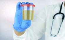 10 bí mật về nước tiểu liên quan đến thận, sức khỏe: Ai cũng nên biết rõ để phòng bệnh tốt