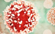 [Đọc nhanh] 10 điều quan trọng ai cũng nên làm ngay để ngăn ngừa nguy cơ mắc ung thư