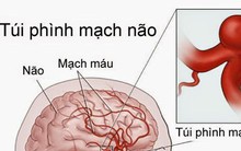 5 tuổi đột quỵ, 8 tuổi đã phải đặt stent: Lời cảnh báo về bệnh lý nguy hiểm ít người biết