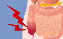 Ruột có sạch thì cơ thể mới khỏe: 7 thực phẩm giúp thải độc ruột hiệu quả ai cũng nên ăn