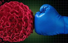 Người làm được 5 việc này, rất ít khi mắc ung thư: Hãy xem bạn có thể tự áp dụng không?