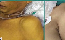 BS Bệnh viện Việt Đức cảnh báo: Đang uống thuốc Tây, bạn uống thêm thứ này thành... tự sát