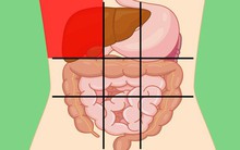 Nhờ "bản đồ bụng" này mà bạn sẽ biết các cơn đau ở mỗi vị trí trên bụng là do nguyên nhân nào gây ra